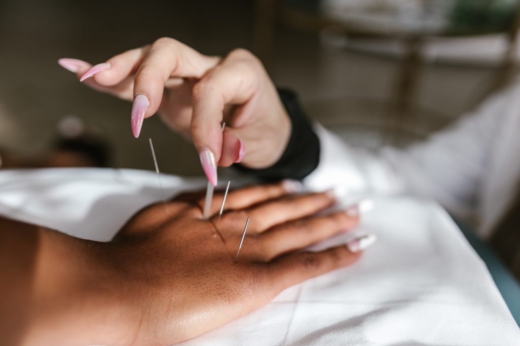 Why Certification Matters When Choosing an Acupuncturist in Your Area