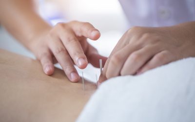 Your First Acupuncture Experience: What to Expect and How to Prepare