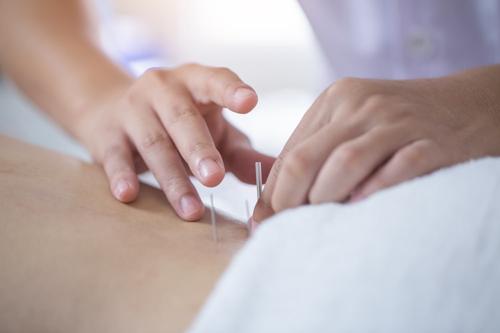 Your First Acupuncture Experience: What to Expect and How to Prepare