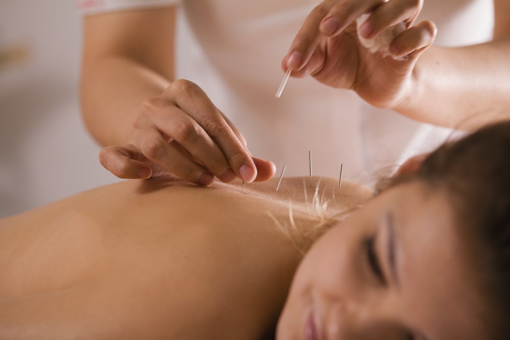The Mind-Body Connection: Enhancing Mental Wellness with Acupuncture