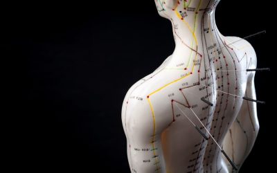 How to Choose the Right Acupuncture Doctor in Chattanooga, TN