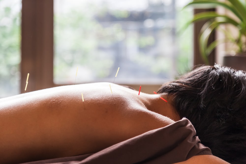 Finding Acupuncture Near Me: Your Comprehensive Guide